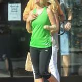 woman with amputated hand