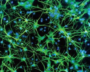 nerve cells with immunoflourescent