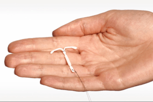 IUD - on hand